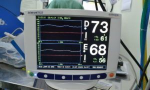 Hospital Unimed Criciúma traz tecnologia inovadora ao Sul