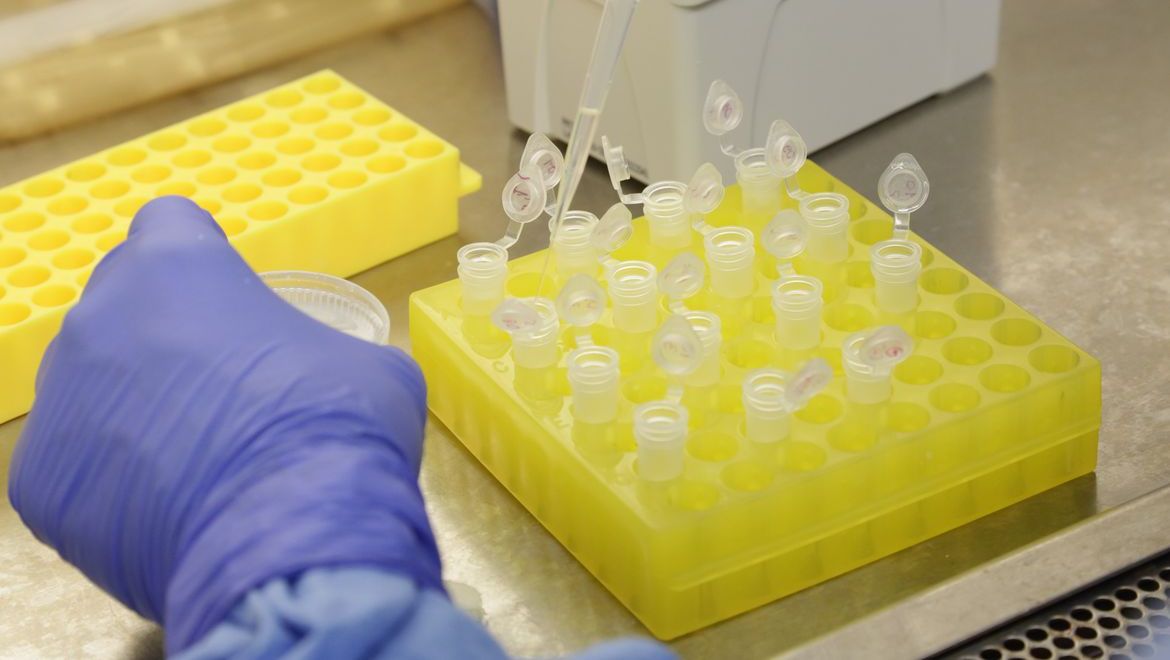 Estado registra 10 mortes em decorrência da Coronavírus desde o início da pandemia