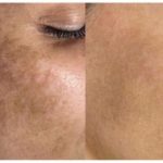 Cronograma Facial: um tratamento eficiente e seguro para uma pele renovada, bonita e saudável