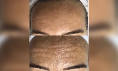 Cronograma Facial: um tratamento eficiente e seguro para uma pele renovada, bonita e saudável