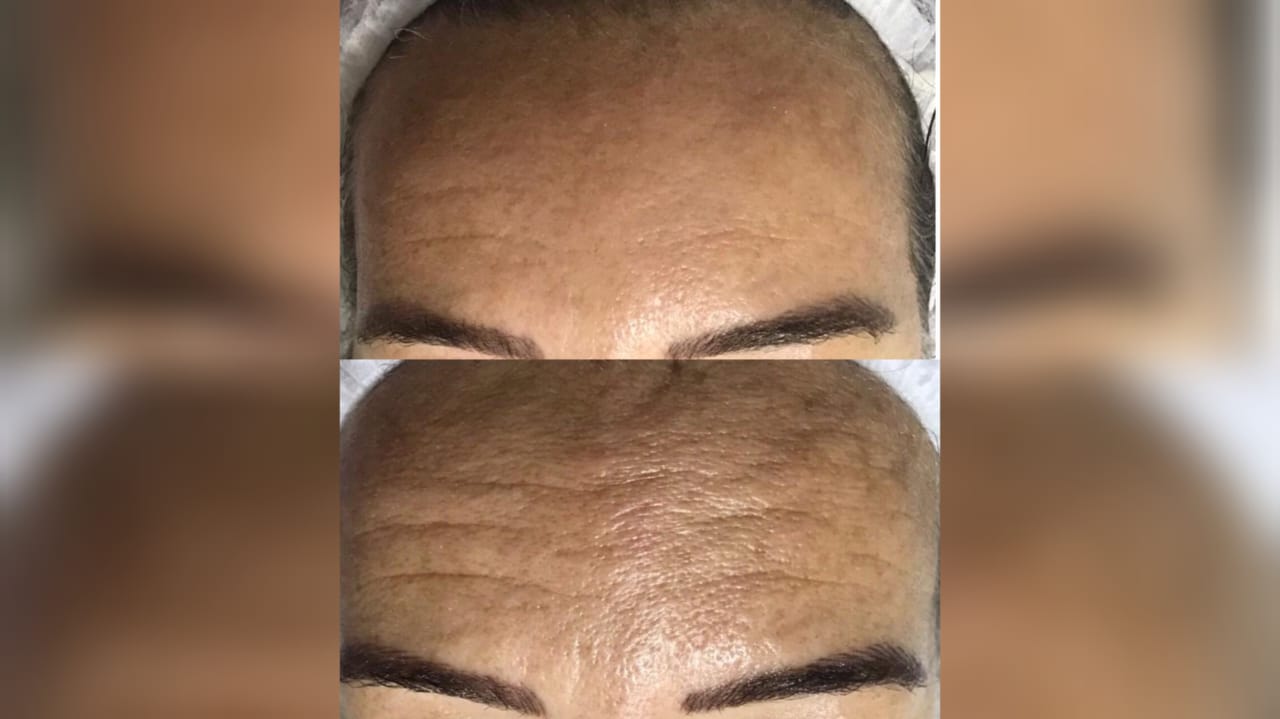 Cronograma Facial: um tratamento eficiente e seguro para uma pele renovada, bonita e saudável