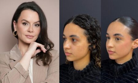 Gabriella Roecker alia técnica e naturalidade em procedimentos de harmonização facial