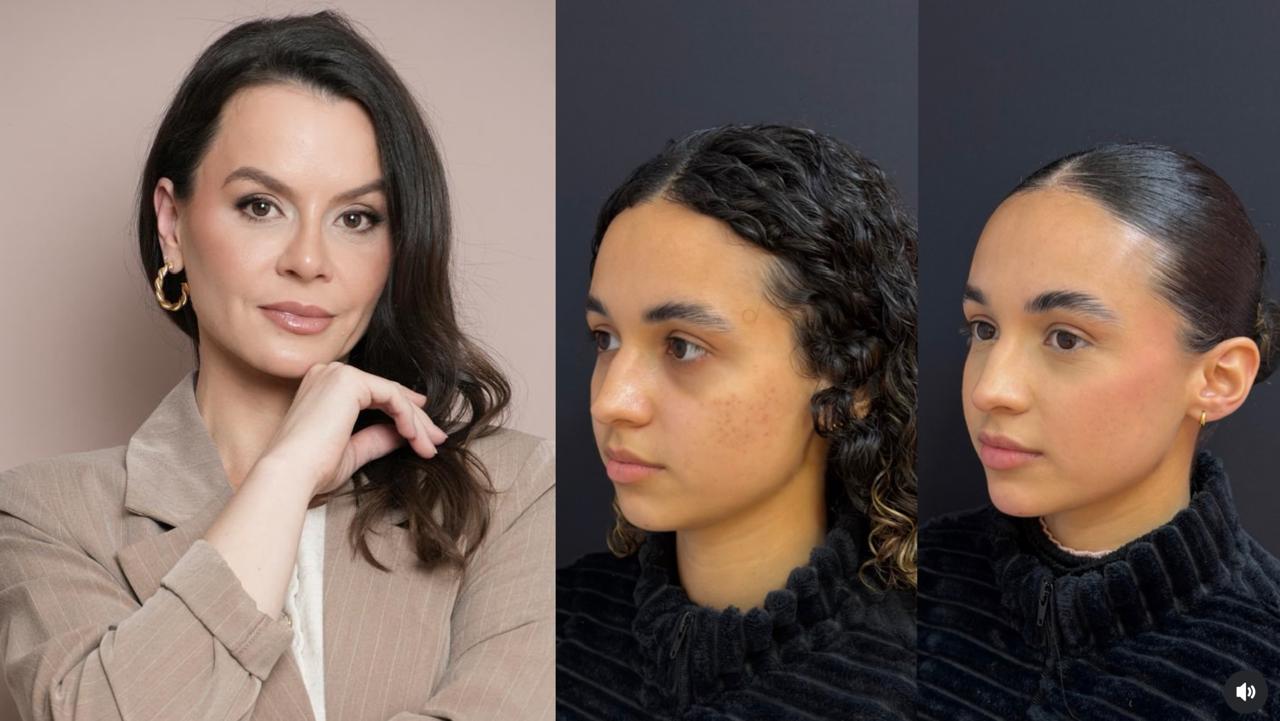 Gabriella Roecker alia técnica e naturalidade em procedimentos de harmonização facial